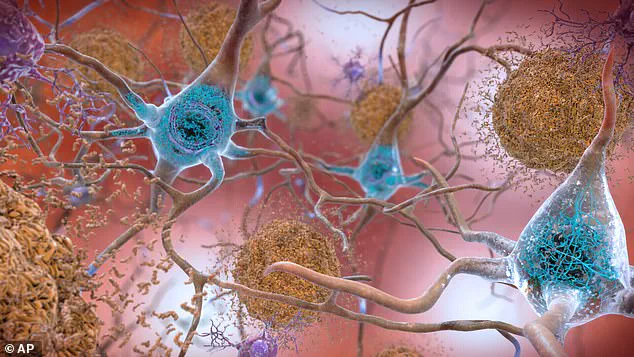 Green Tea Compound and Vitamin Combination Shows Promise in Alzheimer's Research, Published in *GeroScience*