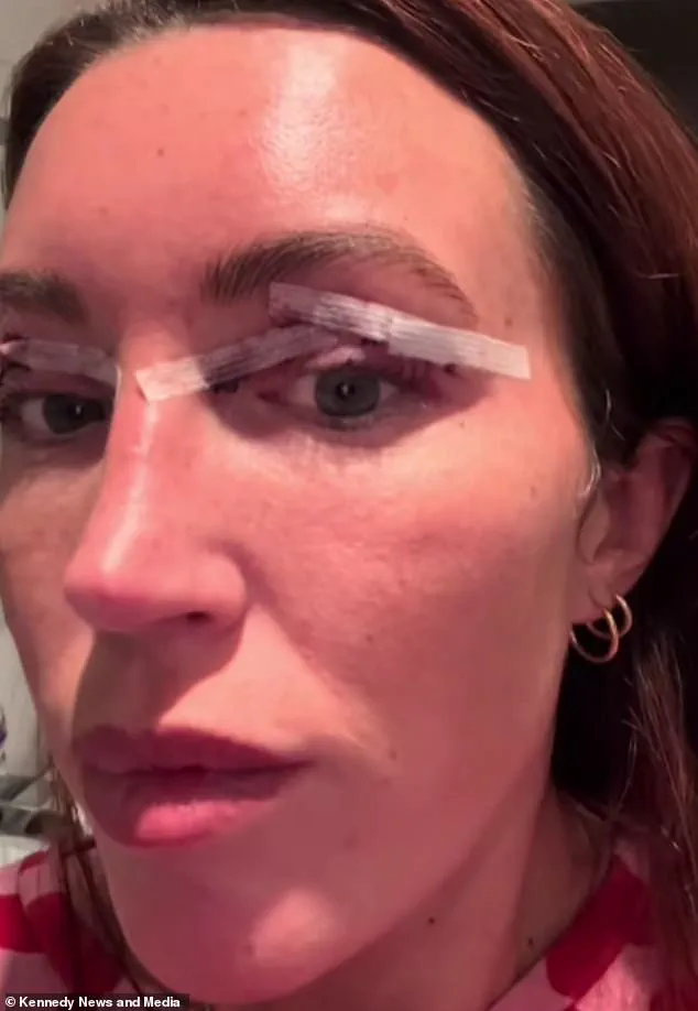 The Societal Pressure on Mothers to Alter Their Appearance: A Growing Trend and Its Community Impact