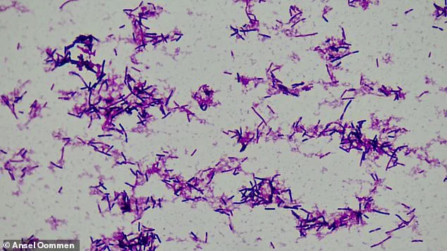 Study Links Gut Bacterium to Increased Risk of Preterm Births