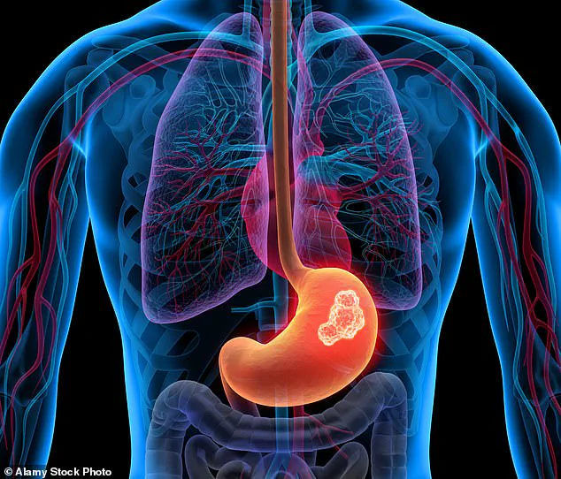 Critical Alert: Indigestion's Overlooked Threat – 40% of Britons Affected by a Condition That May Signal Serious Health Risks