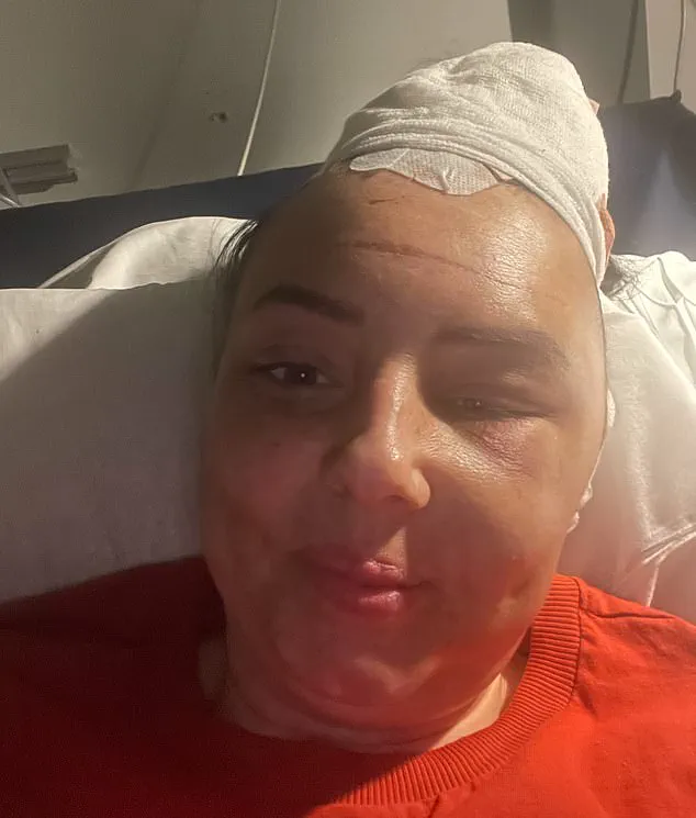 From Skepticism to Survival: How an Extra £10 Eye Scan Saved Lauren Harbert's Life and Sparked a Debate on Tech-Driven Healthcare