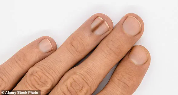 Heed Your Body's 'Whispers': Health Experts Urge Early Detection of Illness Through Subtle Symptoms