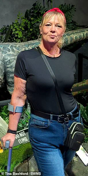 Tina Bashford's Battle with Obesity: From Struggle to Hope