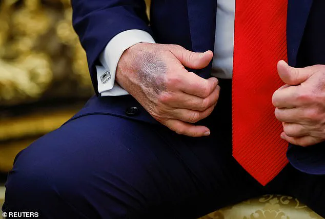 Public Health Experts Sound Alarm Over Trump's Long-Term High-Dose Aspirin Regimen, Citing Defiance of Medical Advice