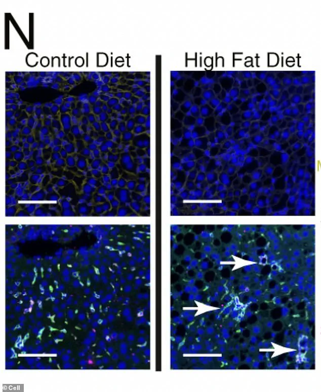 Urgent Warning: High-Fat Diets Linked to Fatal Liver Cancer as New Study Reveals Liver's Alarming Survival Reprogramming
