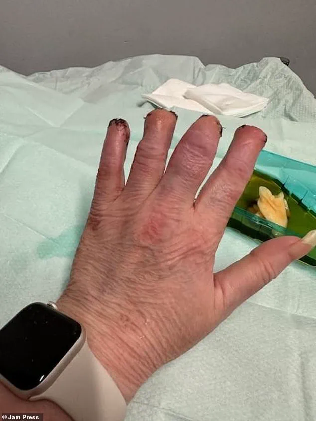 Controversy Over Delayed Medical Intervention for Swansea Woman with Recurring Kidney Stones