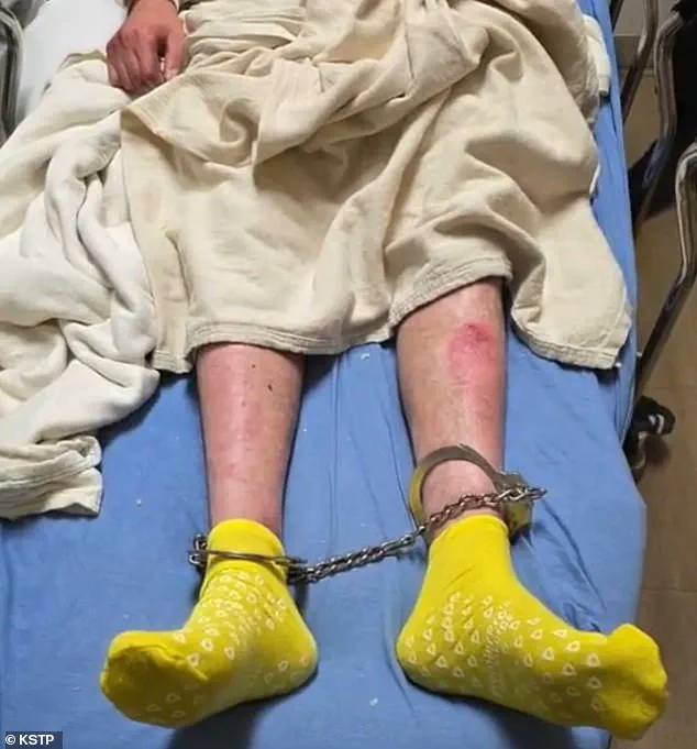 Imminent Deportation Threatens Life of Hani Duklef, Libyan Immigrant with Rare Genetic Skin Disorder Facing Death Sentence in Libya