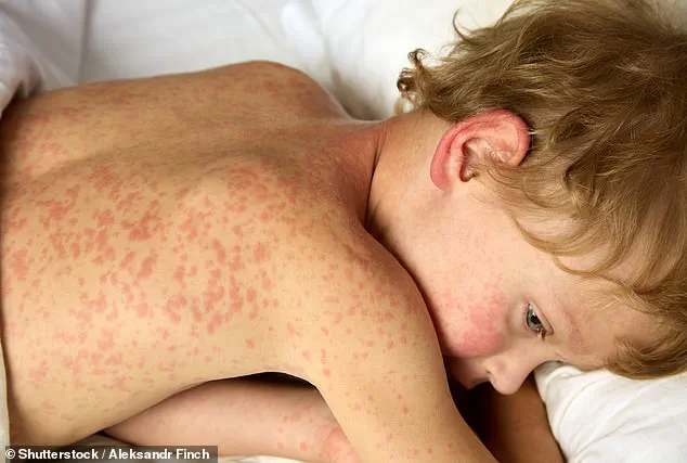 Climate Change and Human Expansion Fuel Emerging Viral Threats