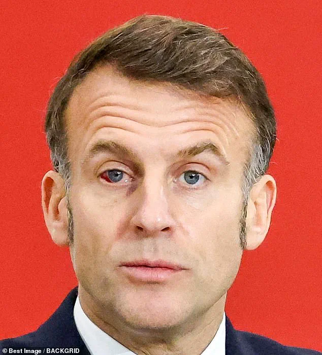 French President's Undisclosed Health Concerns Spark Calls for Transparency and Expert Oversight