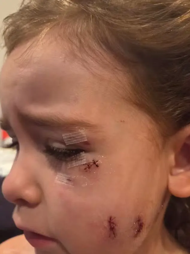 Oshawa Dog Attack Injures Three, Igniting Debate Over Pet Ownership and Safety Laws