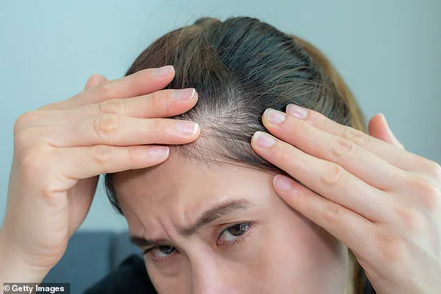 Survey Reveals Over Half of Menopausal Women Experience Hair Loss and Scalp Issues, Study Finds