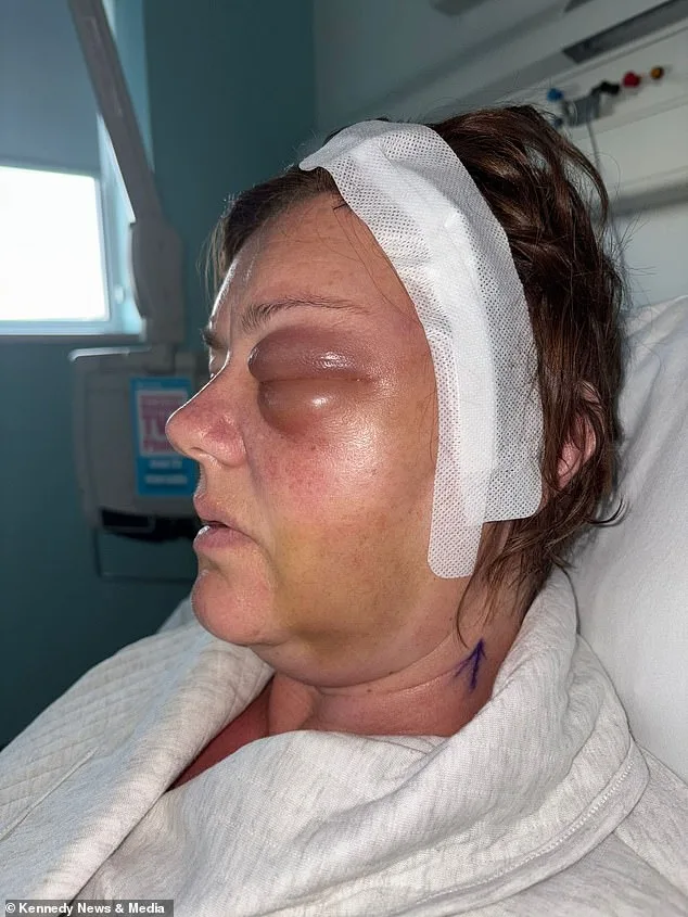 From Blurred Vision to Brain Tumor: How Hormonal Contraceptives May Be Linked to Shelley Whittaker's Rare Diagnosis
