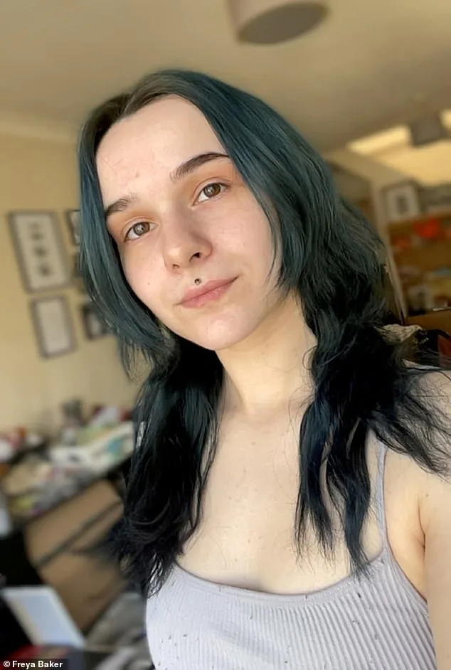 25-Year-Old Woman Faces Homelessness Due to Severe Hyperhidrosis