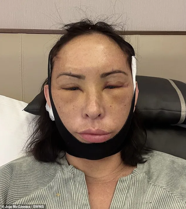 Adelaide Woman Spends £10,000 on Transformative Facelift in Turkey