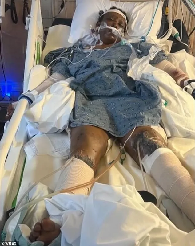 Mississippi Woman's Tragic Dog Attack Sparks Community Reckoning on Safety and Pet Ownership