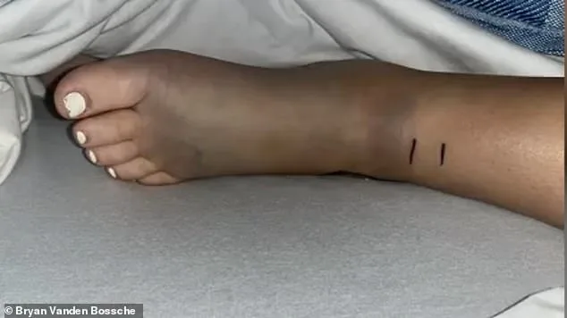 14-Year-Old California Girl's Rattlesnake Bite Turns Routine Bike Ride into Medical Emergency