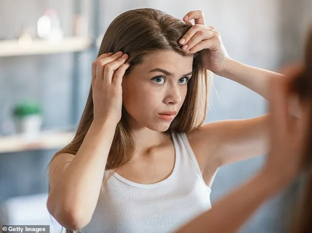 Dandruff Misconceptions Debunked: The Real Culprit Is Malassezia Yeast, Not Dry Skin or Poor Hygiene