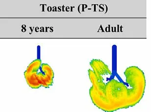 Air Fryers: A Healthy Innovation or Just Hot Air?